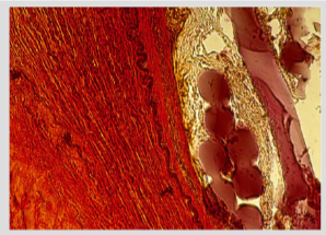 Biodegradable polymers